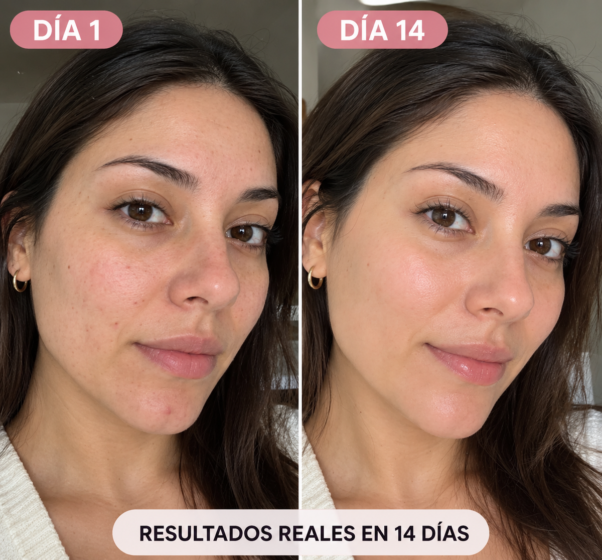 Pack Rutina Skincare – Máscara LED + Set Spa